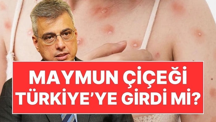 Sağlık Bakanı Memişoğlu'ndan Açıklama: Türkiye'de Maymun Çiçeği Vakası Görüldü mü?