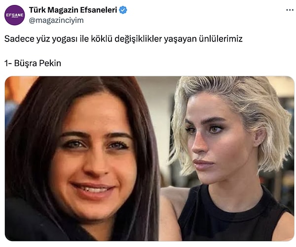 Twitter'da bulunan "Türk Magazin Efsaneleri" isimli hesap, ünlülerin değişimlerini "sadece yüz yogası yaparak" şeklinde, sarkastik bir şekilde paylaştı.