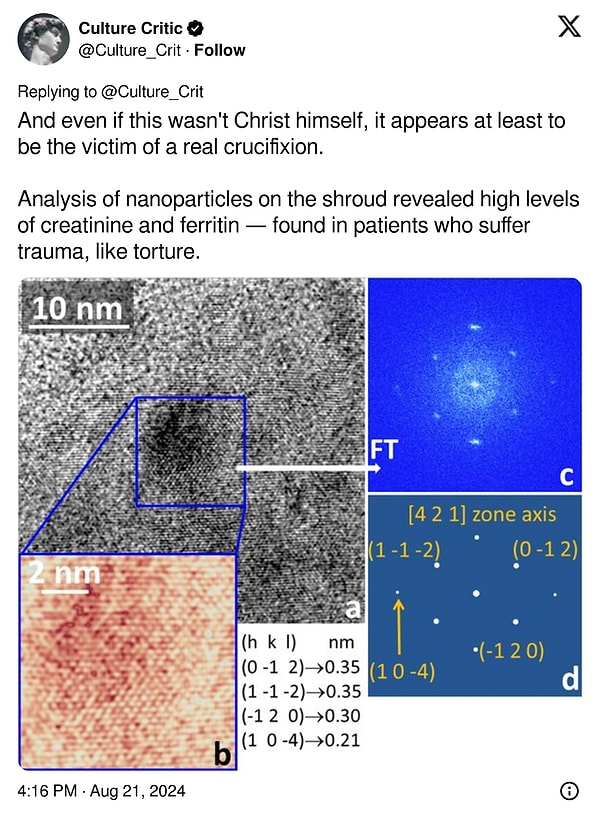 "Ve eğer bu İsa’nın kendisi olmasa bile, en azından gerçek bir çarmıh kurbanına ait olduğu anlaşılıyor. Örtüdeki nanoparçacıkların analizi, travma geçirmiş, örneğin işkence görmüş hastalarda bulunan yüksek seviyelerde kreatinin ve ferritin tespit etti."