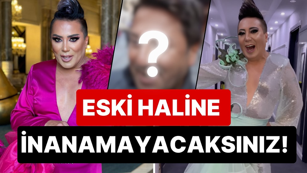 Mod Değişiklikleriyle Ünlü Fenomen Murat Övüç'ün Bir Düzine Estetik Yaptırmadan Önceki Haline Şok Olacaksınız!