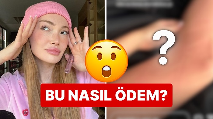 Bu Nasıl Ödem? Danla Bilic'in Porselen Desenli Bacağıyla İmtihanı Dumura Uğrattı!