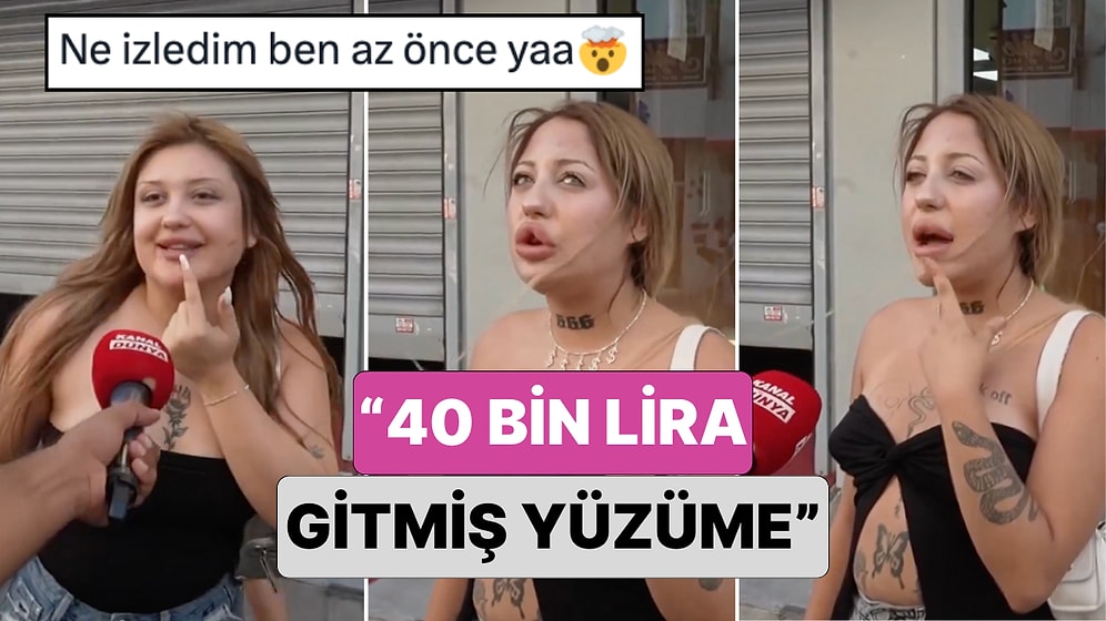 Estetik Çılgınlığı Nereye Gidiyor?Bir Sokak Röportajında Geçirdikleri Estetik Operasyonların Ücretleri Soruldu