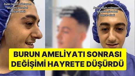 'Öncesi' ve 'Sonrası' Fotoğrafı Gündem Oldu: Burun Ameliyatı Olan Gencin Yüzündeki Değişim Hayrete Düşürdü