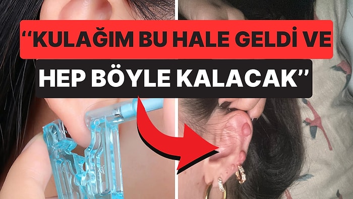 Evde Kulak Delme Denemesi Fiyasko ile Sonuçlanan Kadından Uyarı: ''İşi Bilene Bırakın''