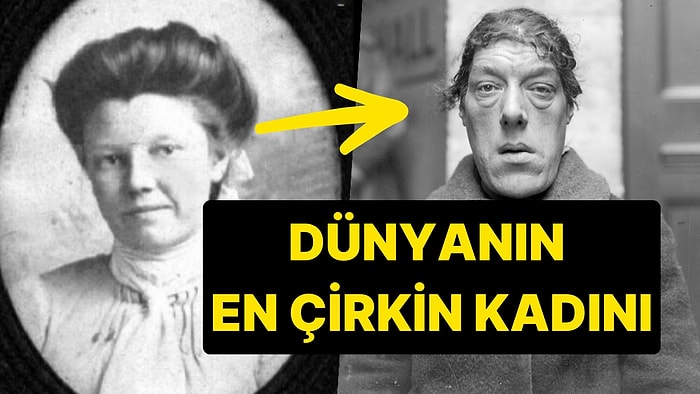 Dünyanın En Çirkin Kadını Olarak Kendini Feda Edip Çocukları İçin Sirklerde Çalışan Mary Ann Bevan'ın Hikâyesi