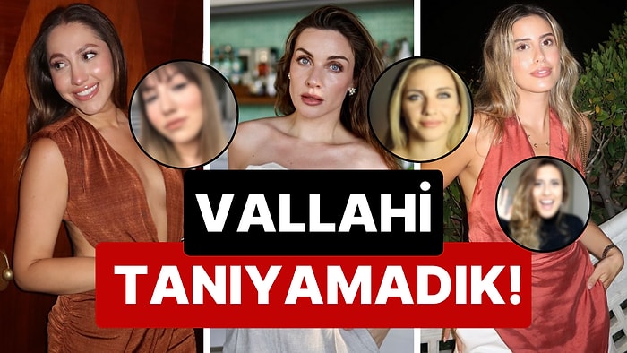 Hayatlarının Her Anını, Dolayısıyla da Değişimlerini Yakından Takip Ettiğimiz Influencerların Önceki Halleri