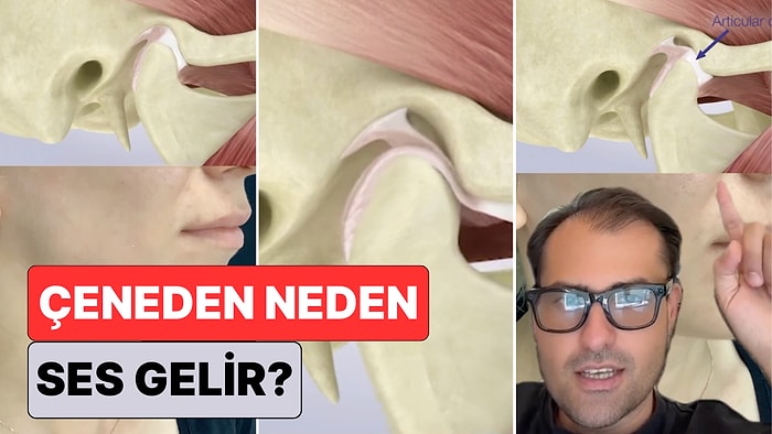 Bir Doktor Soru İşaretlerini Giderdi: Pek Çok Kişinin Muzdarip Olduğu Çene Kıtlaması Neden Olur?