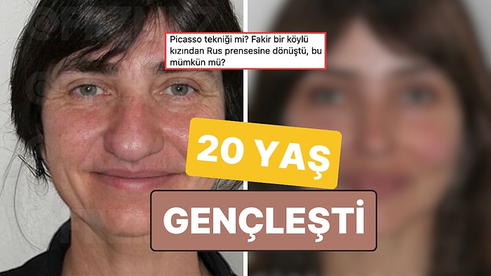 Estetik İşlemlerle Adeta Gençlik İksiri İçmiş Gibi Görünen ve 20 Yaş Gençleşen Kadın