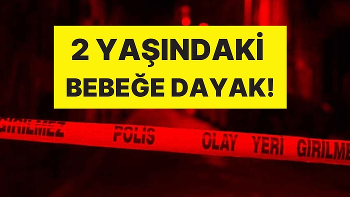 Anne Tutuklandı: 2 Yaşındaki Bebeğe Dayak, Beyin Kanaması Geçirdi