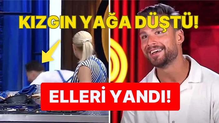 MasterChef Yarışmacısı Yayında Geçirdiği Talihsiz Kaza Yüzünden Yarışmadan Ayrıldı İddiası!