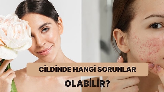 Cilt Bakım Rutininden Bahset, Yaşayabileceğin Cilt Problemlerini Söyleyelim!