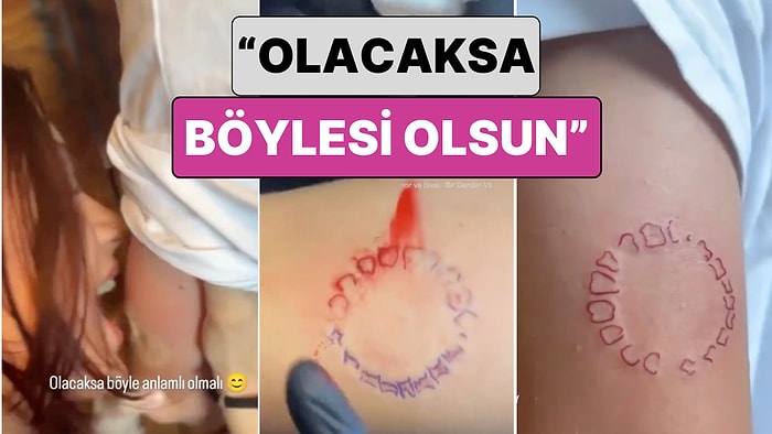 Bir Genç "Olacaksa Böyle Olsun" Diyerek Sevgilisinin Isırık İzinin Dövmesini Yaptırdı