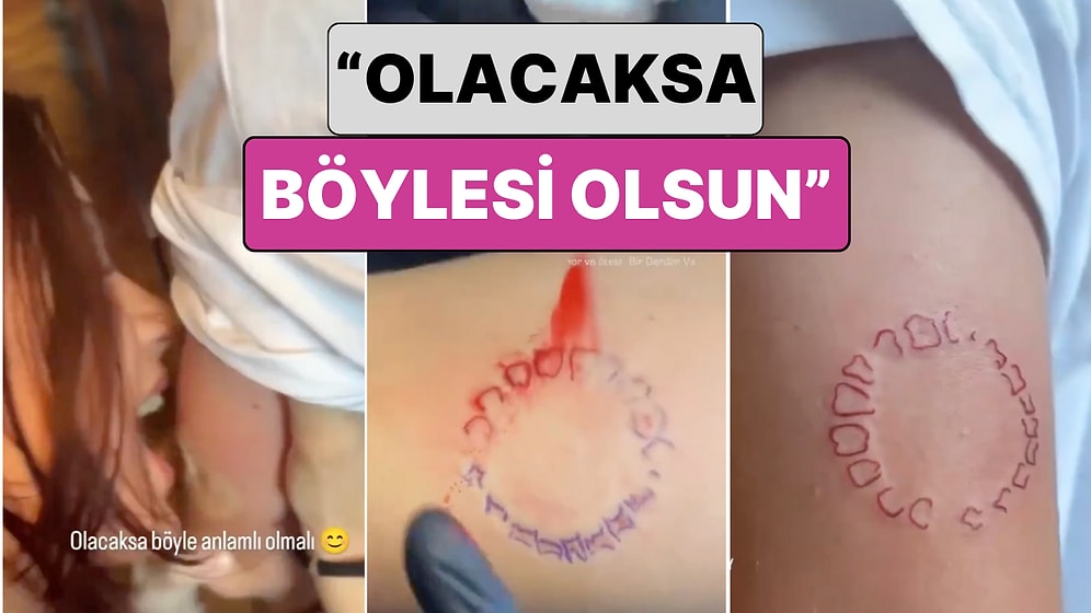 Bir Genç "Olacaksa Böyle Olsun" Diyerek Sevgilisinin Isırık İzinin Dövmesini Yaptırdı