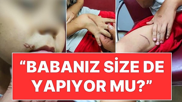 Narin Güran, Sıla Bebek ve çok daha fazlası... Türkiye son günlerde birbiri ardına gelen çocuk cinayetleri ve istismarları ile sarsılıyor. İstanbul'da 8 yaşındaki Kudret Hamrayev isimli bir çocuk da babasının kızgın tornavidalı işkencesine maruz kaldı. Olay, acı seslerini duyan mahallelinin ihbarıyla ortaya çıktı. Ayrıca işkenceye maruz kalan Kudret'in arkadaşlarına, "Babanız size de ceza veriyor mu?" şeklinde sorular sorduğu öğrenildi.