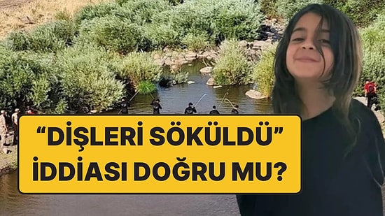 Narin’in Dişlerine Ne Oldu? Adli Tıp Uzmanı “Dişler Sökülmüş” İddiasını Yorumladı