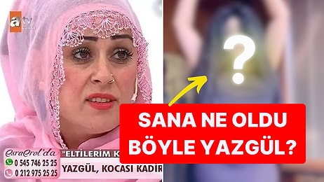 Esra Erol'da "Tek Suçum Güzel Olmak" Sözüyle Tanınan Yazgül Estetikle Başka Biri Oldu!