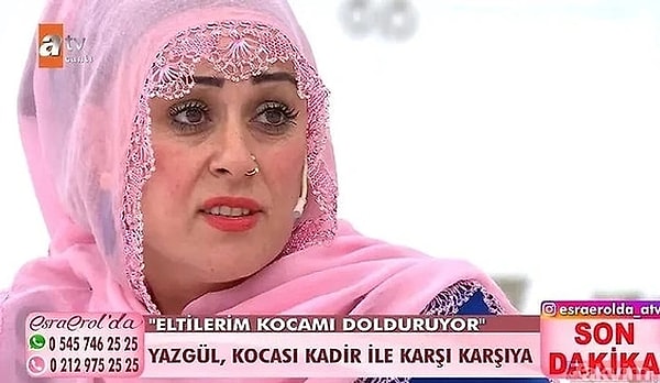 15. Esra Erol'un programında "Tek suçum güzel olmak" sözüyle tanınan Yazgül, estetikle başka biri oldu. Yeni halini "Shakira oldum" notuyla paylaştı.