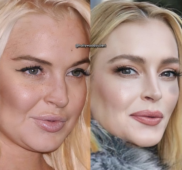 Zaten çok güzeldi ama Lindsay Lohan dönemin estetik algılarını kendine öyle bir adapte etti ki kendisinin eski yüzüne bakınca sanki bambaşka birine bakıyoruz!