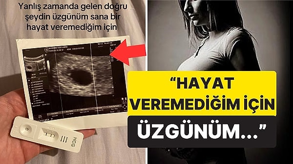 Geçtiğimiz günlerde bir TikTok kullanıcısı, bebeğinin ultrasonunu paylaşarak aldırmak zorunda kaldığını dile getirdi. Bu süreçte ilaç kullandığını ve radyasyona maruz kaldığını dile getiren kadının feryadı yürekleri burktu.