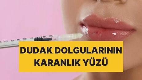 Yeni Araştırma Ortaya Koydu: Dudak Dolgusu Kansere Yol Açabilir