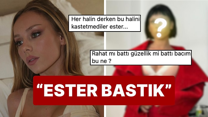 Elite Dizisinin Carla'sı Ester Exposito'nun Yeni Saç Stili "Ne Yaptın Kendine?" Dedirtti