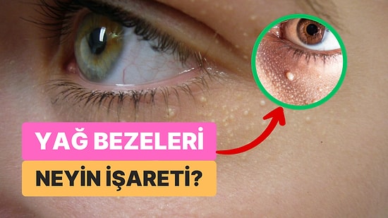 Göz Çevresindeki Beyaz Noktalar-Yağ Bezeleri Sağlığımızla İlgili Neye İşaret Ediyor?