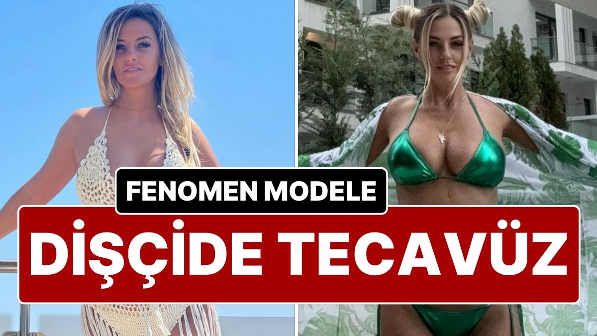 Sosyal Medya Fenomeni Stefania Costache, Dişçiye Gitti, Uyutulup