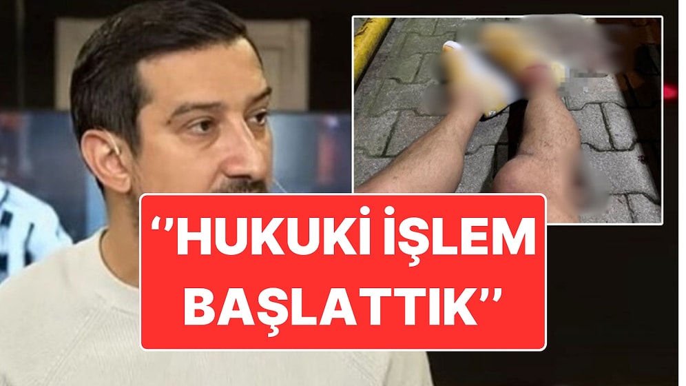 Fenerbahçe, Serhat Akın'a Yapılan Silahlı Saldırıya İlişkin Atılan İftiralar Hakkında Hukuki İşlem Başlattı