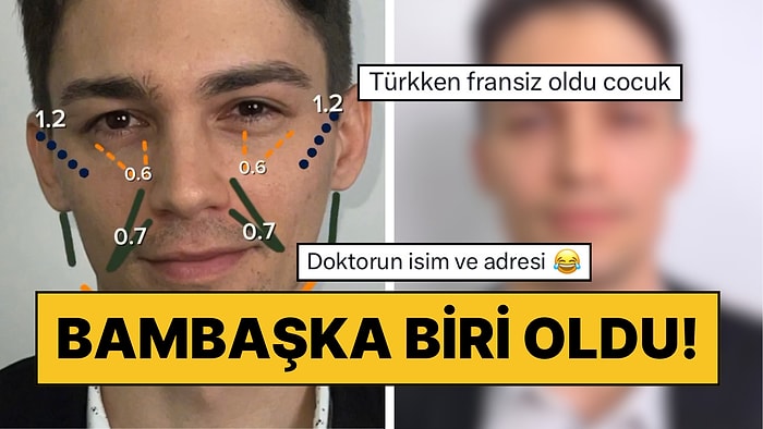 Yüzüne Yaptırdığı Estetik Operasyonlarla Bambaşka Bir Karizmaya Sahip Olan Adama Beğeni Yağdı