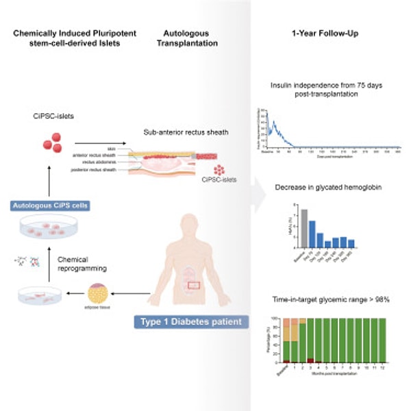 Peki, tip 1 diyabeti kök hücre ile tedavi etmeyi sağlayan yeniden programlama nasıl gerçekleştirildi?