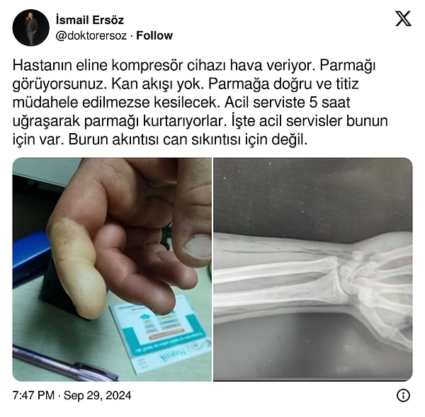 Dr. İsmail Ersöz Twitter hesabından, acile gelen bir vakayı paylaşarak ''İşte acil servisler bunun için var. Burun akıntısı can sıkıntısı için değil.'' dedi.