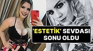 Estetik Uğruna Hayatından Oldu! 8 Saatte 6 Estetik Operasyon Geçirdi, Hayatını Kaybetti