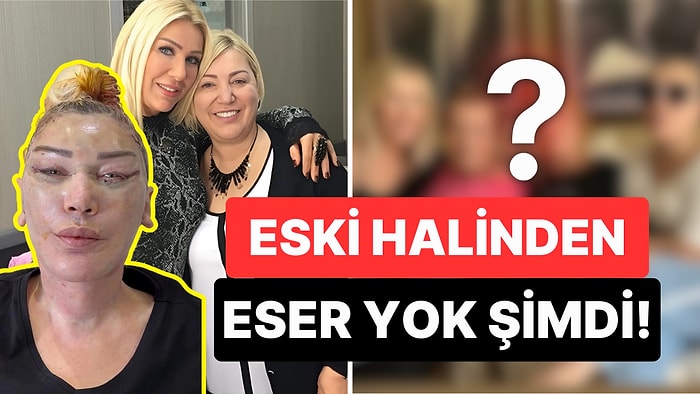 Üç Kuşak Estetik: Annesinin Yanına Giden Seda Sayan’ın Ameliyatla Bambaşka Biri Olan Ablasını Kimse Tanıyamadı