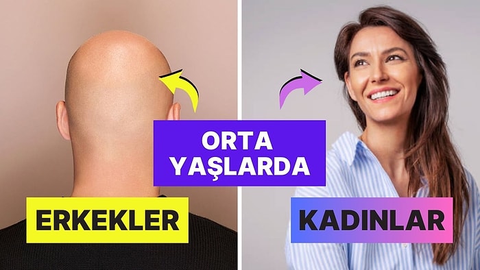 Erkekler Orta Yaşlarda Kelleşmeye Başlarken Kadınlar Neden Aynı Sorunu Yaşamıyor?