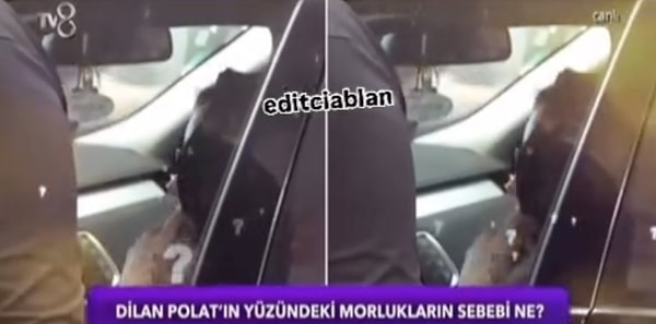 Muhabirlerle ayaküstü tartışan 'korumalar' geçide izin vermezken, Dilan Polat'a biraz olsun yaklaşıp görüntü alabilen muhabir, yüzünde morluklar olduğunu iddia etti. Hatta, "Geçmiş olsun, yüzünüze ne oldu?" diye sordu. Bu sırada gözlüklerini takan Dilan Polat, başını ve yüzünü de örtmeye çalıştı.