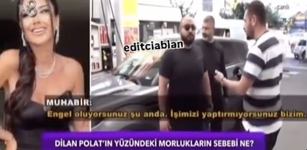 Geçtiğimiz saatlerde ise enteresan bir olay yaşandı. TV8 muhabirlerinin kameralarına takılan Dilan Polat, arabasından hiç çıkmadığı gibi kapısına da amca oğullarım dediği 'korumalarını' dikti.