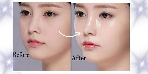 4. K-Beauty rutini denildiğinde ilk hangi adım seni cezbediyor?