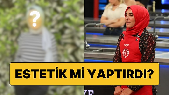 MasterChef'te Gönülleri Kazanan Ayşe Ekiz'in Değişimi Akıllara "Estetik mi Yaptırdı?" Sorusunu Getirdi!