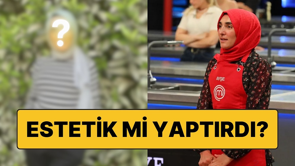 MasterChef'te Gönülleri Kazanan Ayşe Ekiz'in Değişimi Akıllara "Estetik mi Yaptırdı?" Sorusunu Getirdi!