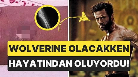 Wolverine'e Dönüşmek İçin Koluna Cıva Enjekte Eden Çocuğun Hayatı Sorgulatan Hikayesi