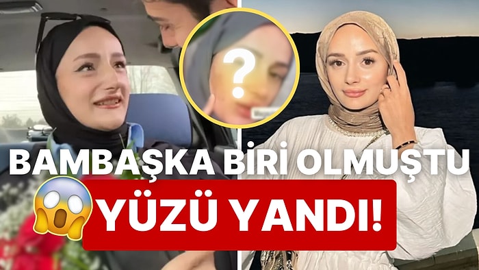 Yüzü Yandı: Tüm Türkiye'ye "Amin" Dedirten TikTok Fenomeni Gizem Yıldız, Estetik Kurbanı Oldu!