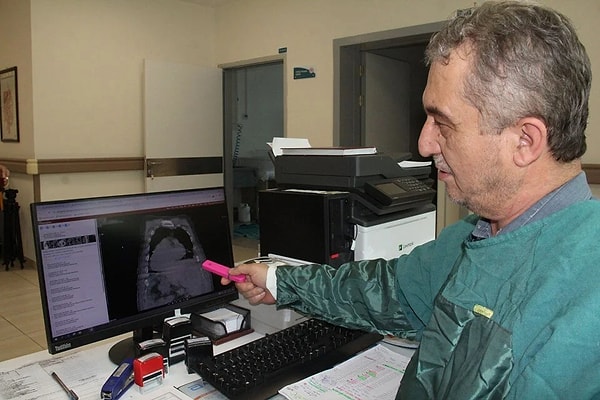 Giresun Eğitim ve Araştırma Hastanesi Gastroenteroloji Anabilim Dalı Başkanı Prof. Dr. Ahmet Cumhur Dülger, hastalığa dair şunları söyledi: