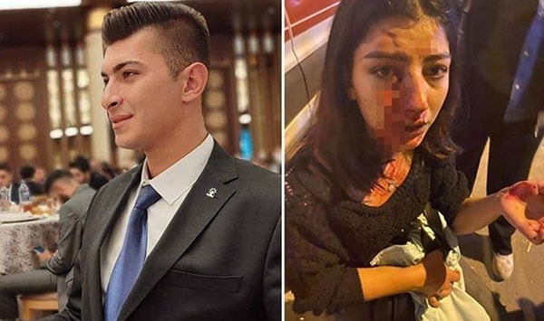 İddiaya göre, yer sırası tartışmasından dolayı AK P Keskin Gençlik Kolları Başkanı Melih Ünlüer, Fatma Banu Çoban'ı darbetti. Şiddet sonrası hastaneye kaldırılan ve ameliyat olan Çoban 2 gün sonra taburcu olurken, Ünlüer ise olay günü alınan ifadesinin ardından serbest bırakıldı.