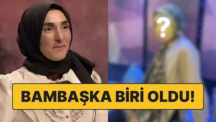 Estetik İddiasıyla Gündeme Gelen MasterChef Ayşe'nin Eleme Sonrası Değişimi Dikkatlerden Kaçmadı!