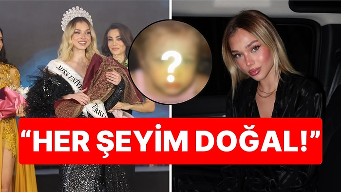 Miss Universe Türkiye 2024 Birincisi Ayliz Duman Estetik İddialarına Açıkça Cevap Verdi!