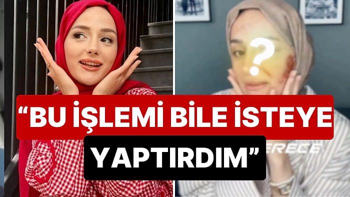 Böyle Geri Vites Görülmedi: Estetik İşlem Sonrası Yüzü Yanan 'Amin Reis' Gizem Yıldız'dan Bir Garip Savunma