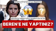 Bir Estetik Kurbanı Daha: Beren Saat'in Yüzündeki Büyük Değişim Görenlere Küçük Çaplı Bir Kalp Krizi Geçirtti