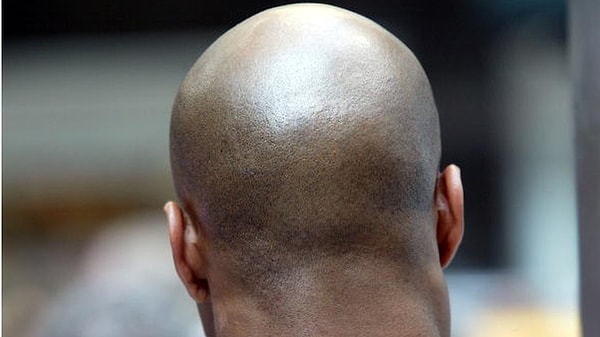 In the February 2022 ruling, it was proven that Finn was wrongfully dismissed and verbally harassed for his baldness.