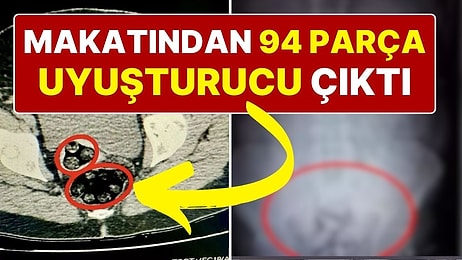 İranlı Uyuşturucu Kuryesi Kadının Makatında 94 Parça Uyuşturucu Yakalandı