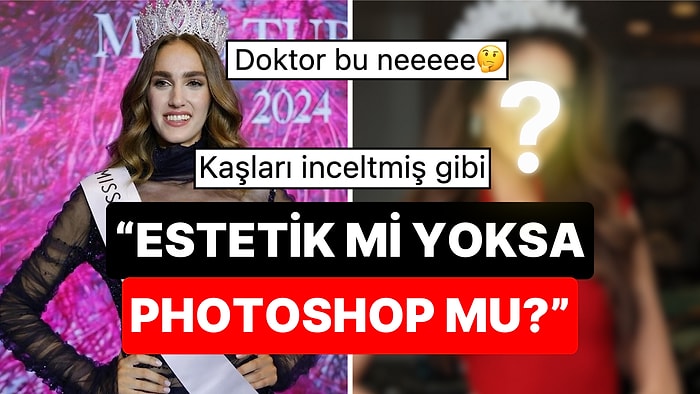 "Estetik mi Olmuş?": Miss Turkey 2024 Birincisi İdil Bilgen'in Son Haline Yorum Yağdı!